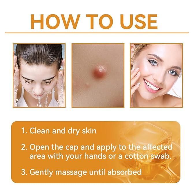 Bee Venom Skin Treatment Cream 100g
